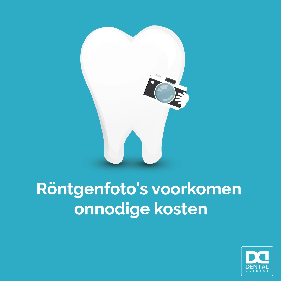 Röntgenfoto's voorkomen tandartskosten - tandartstip Dental Clinics