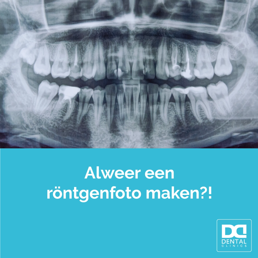 Hoe vaak röntgenfoto bij tandarts - controle tandarts Dental Clinics